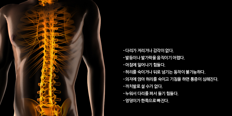 자가진단