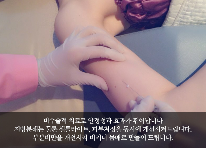 바디매선의 특징